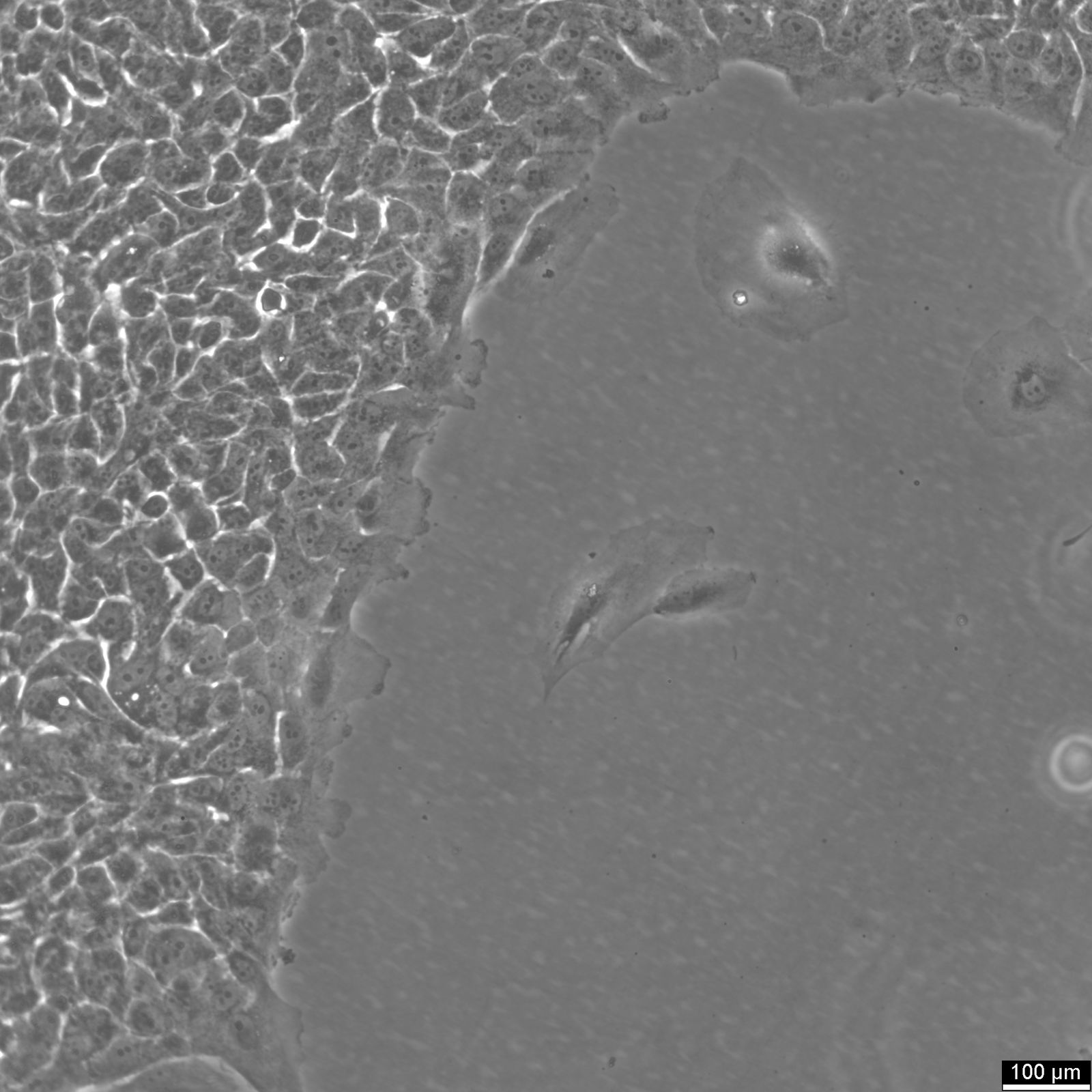 MCF10A Cells