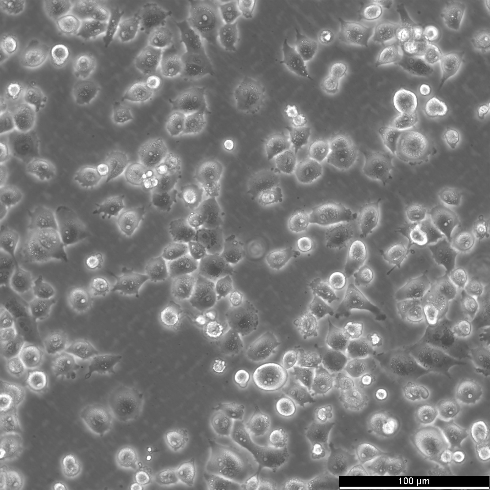 NCI-H1299-EGFP-Zellen