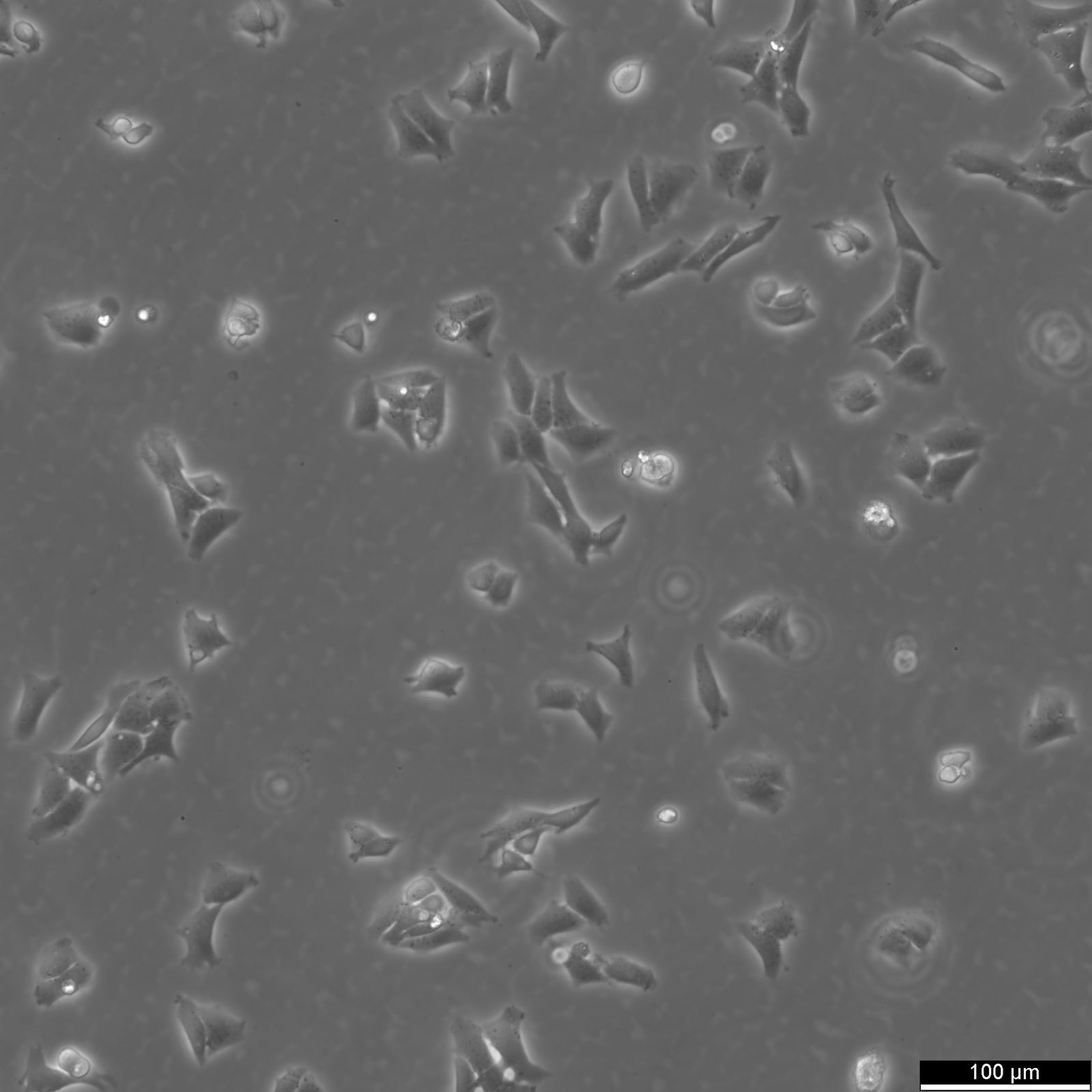 CHO Cells