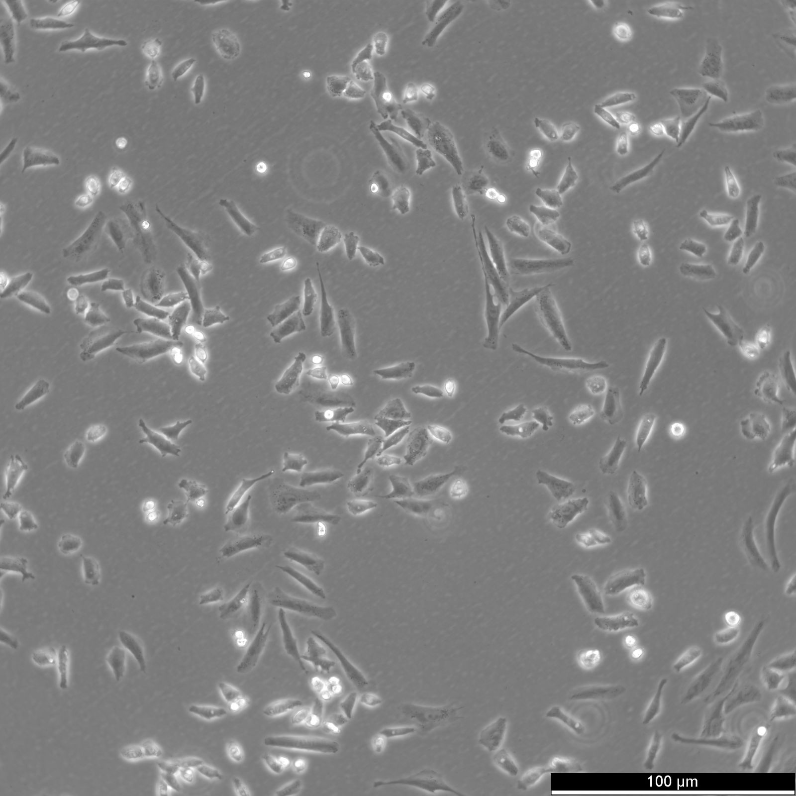 NCI-H1703 Cells