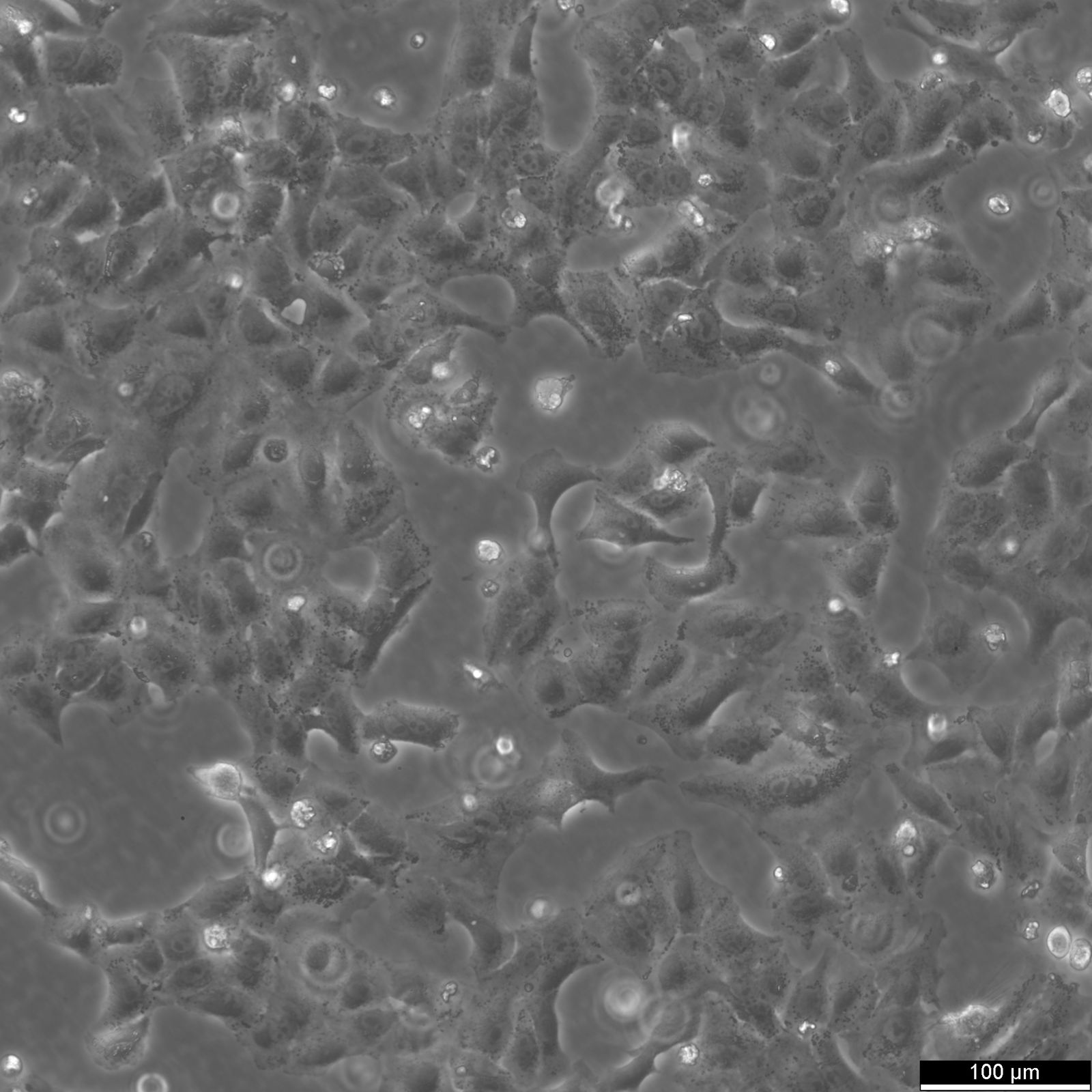 A549 Cells A549 Cells