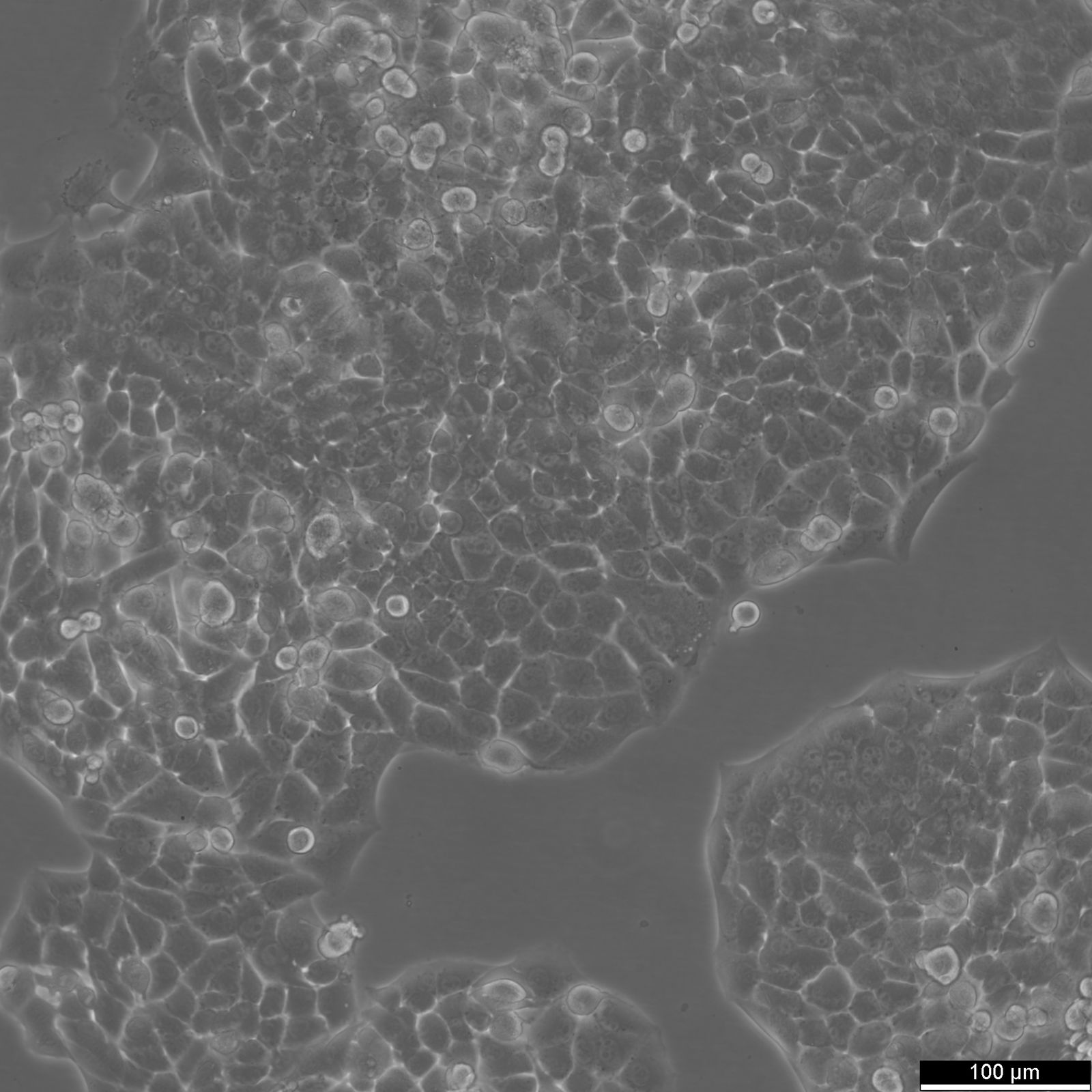 RenCa Cells RenCa Cells