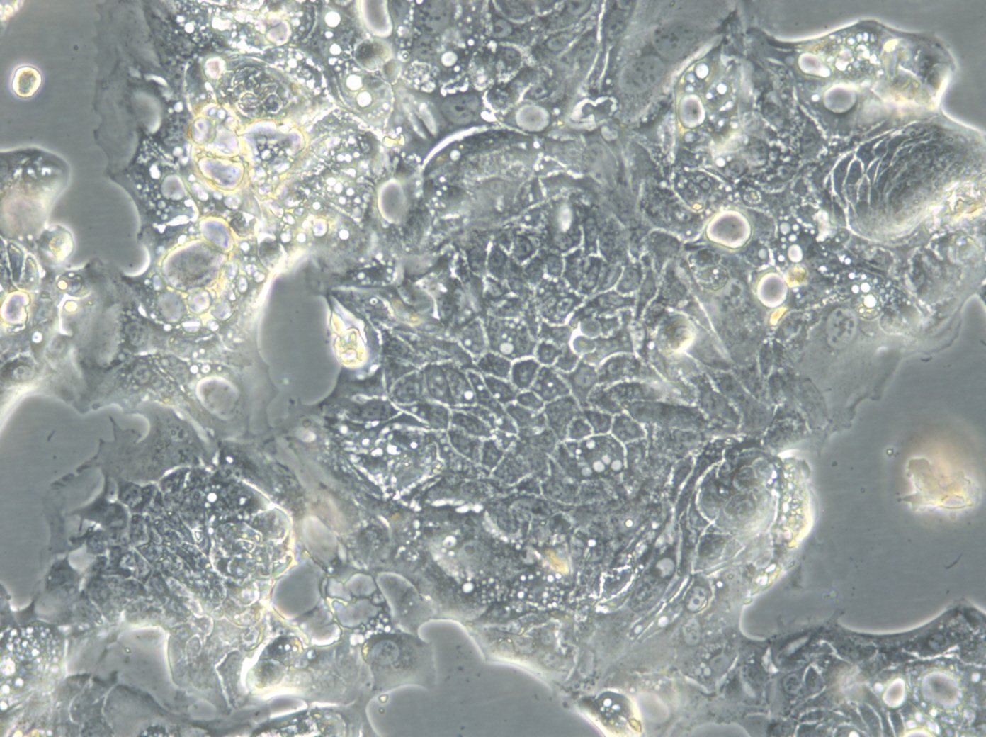 Cellules HROC32 T3 M1