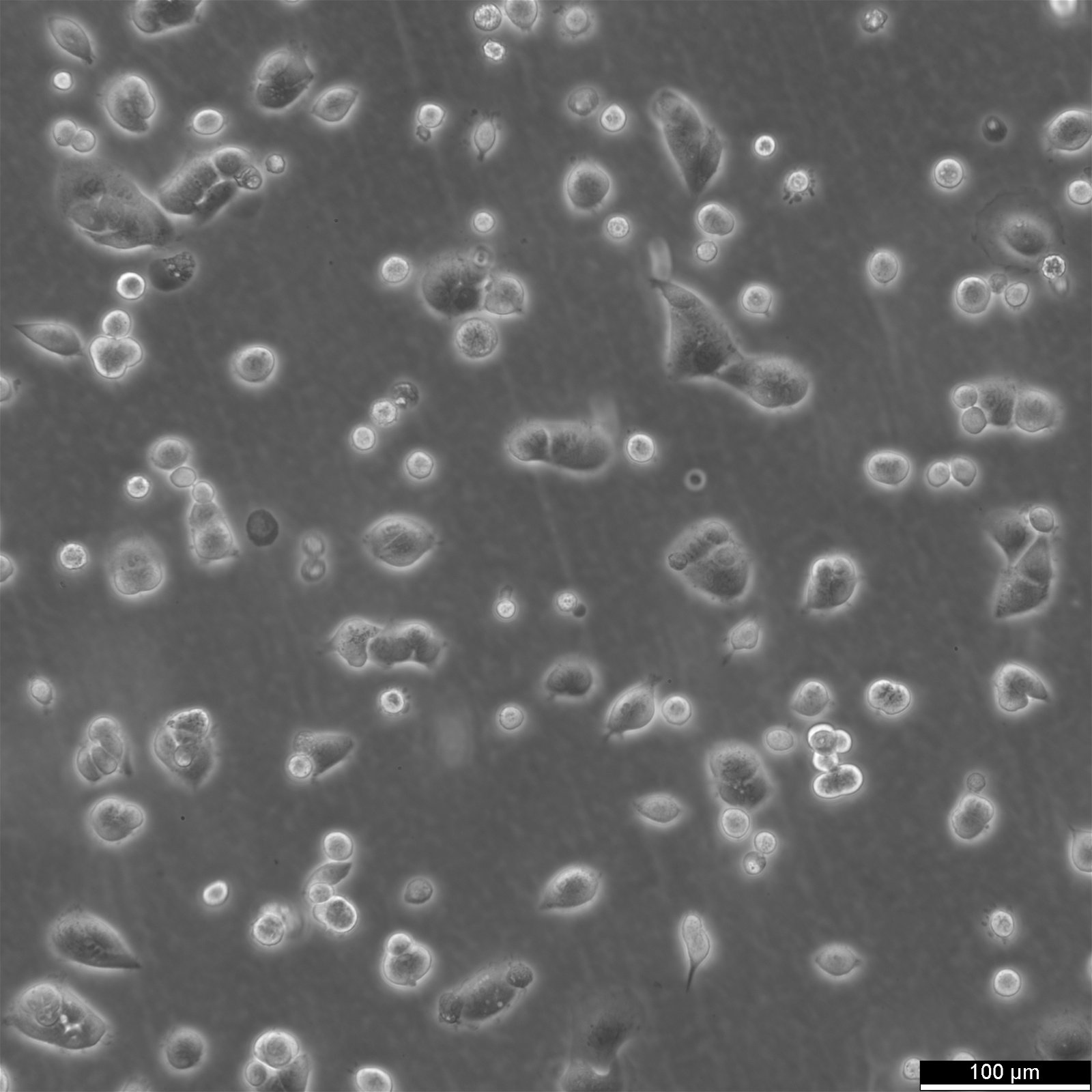 MKN-74 Cells
