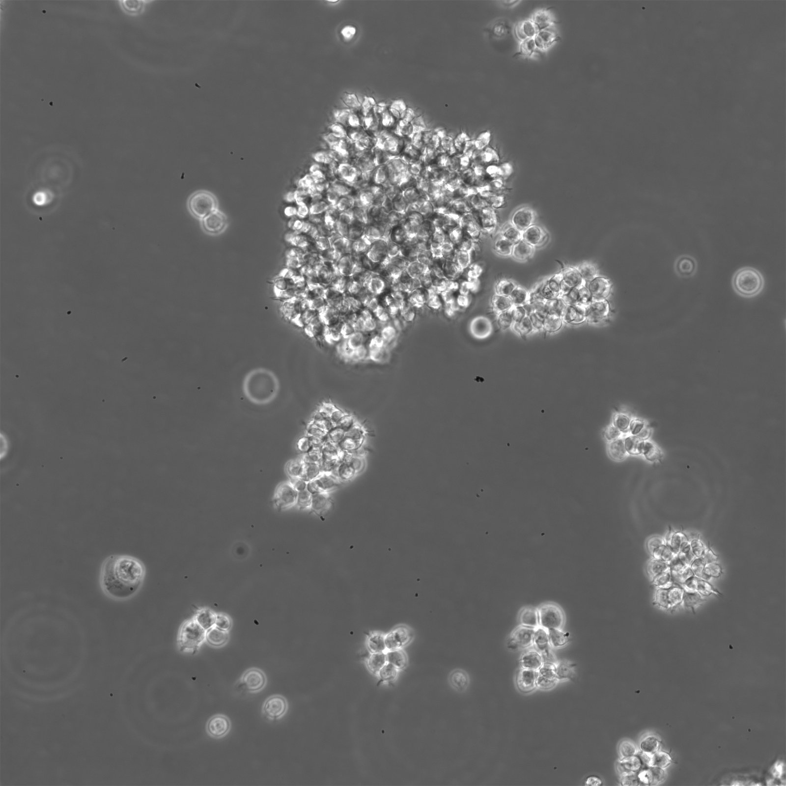 P3HR1-Zellen