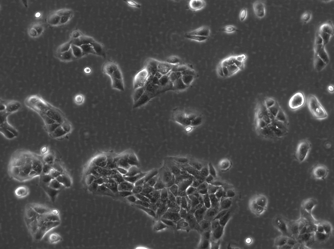 Cellules HaCaT-ras A5