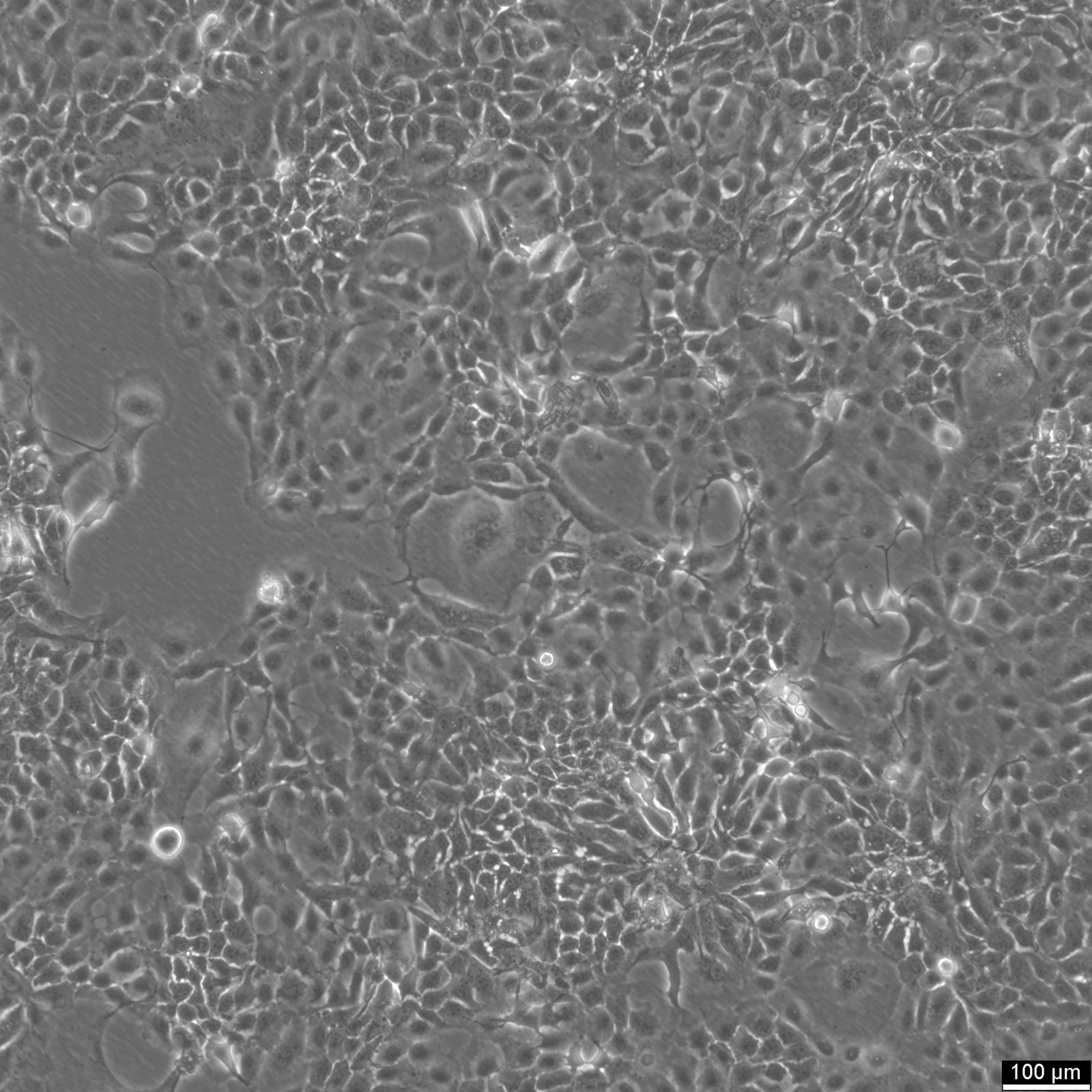 CLS-354 Cells CLS-354 Cells