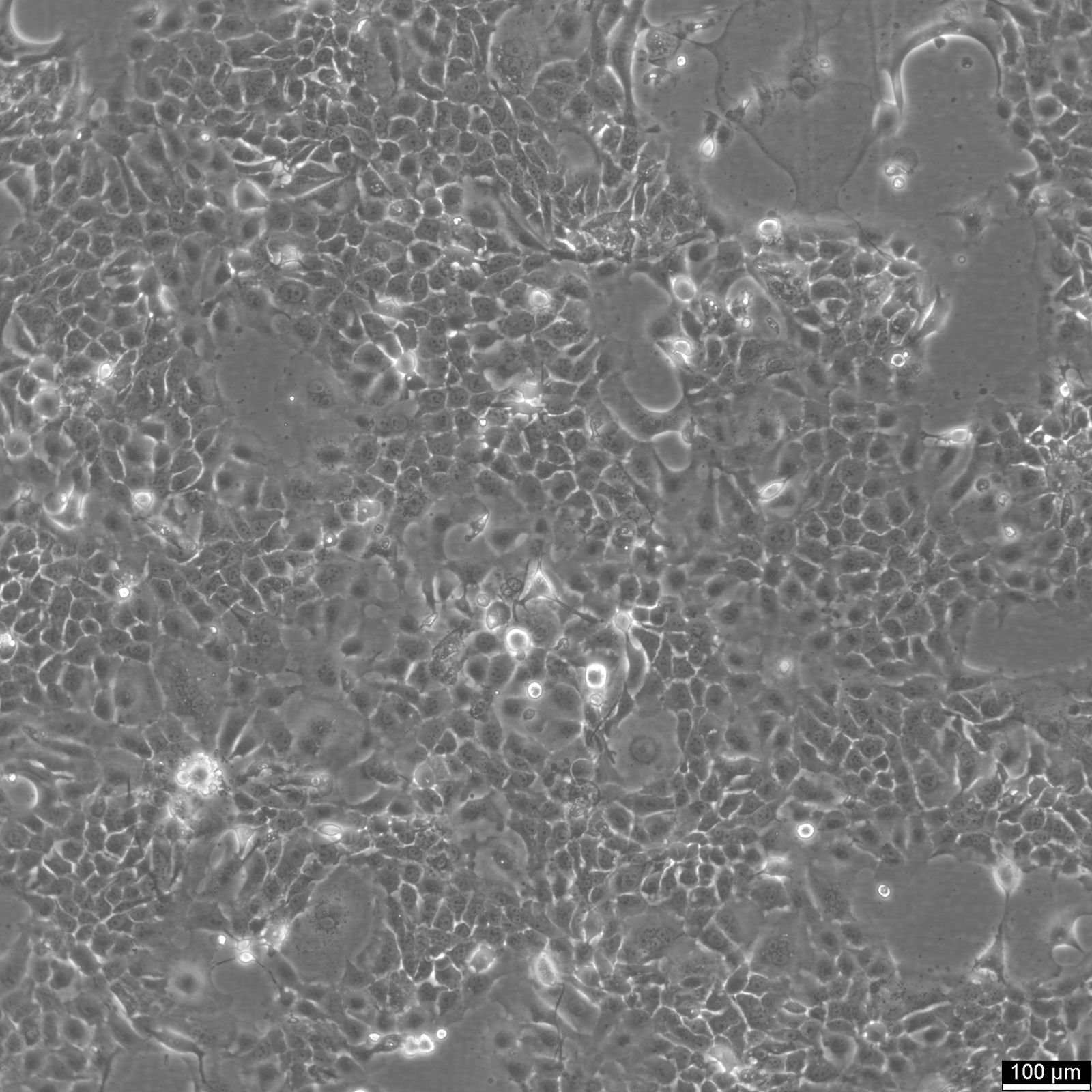 CLS-354 Cells CLS-354 Cells