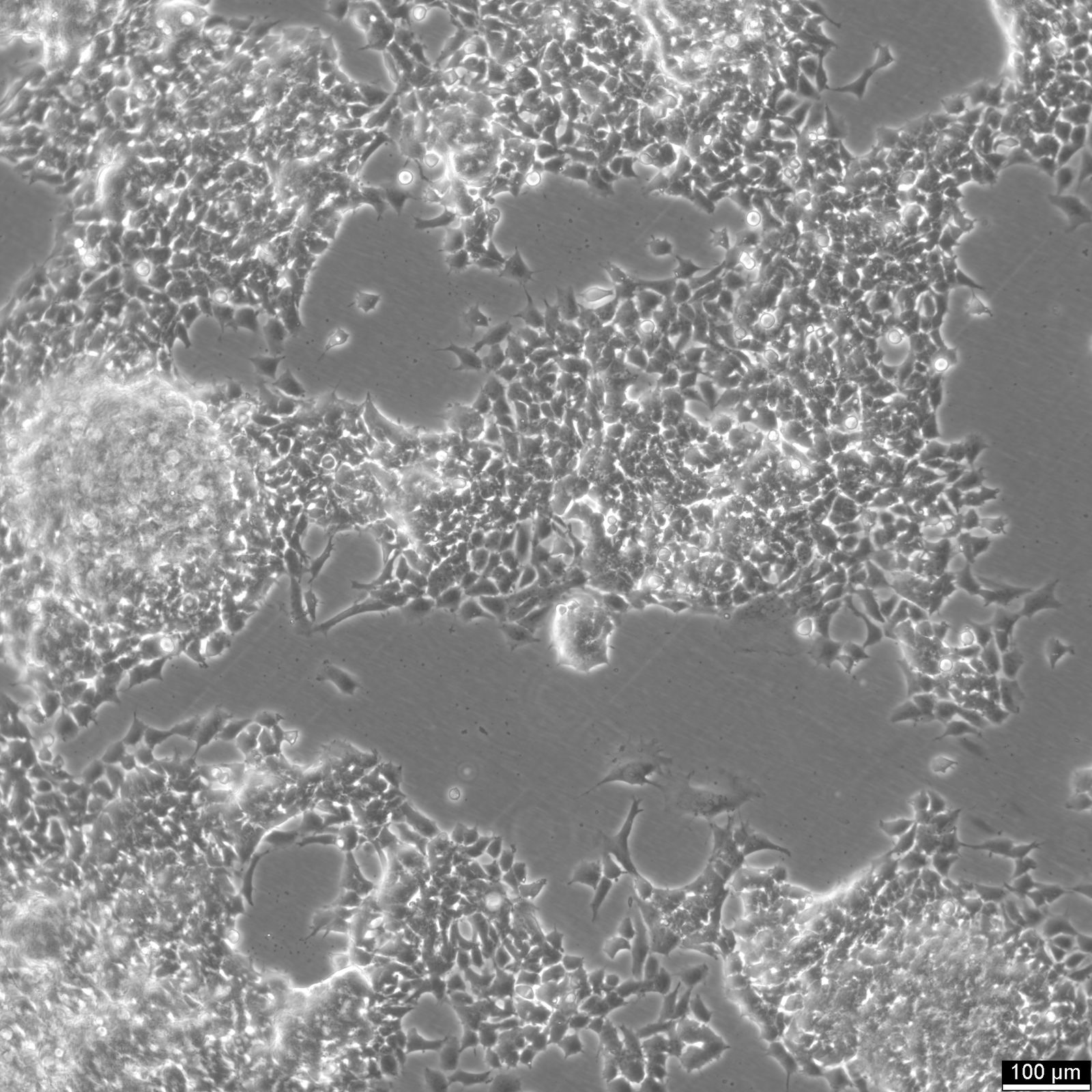 RD-ES Cells RD-ES Cells