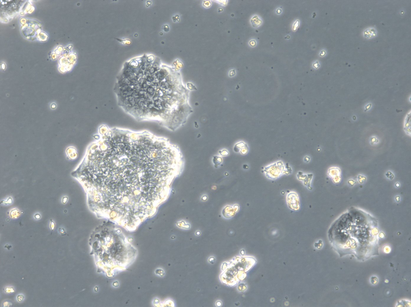 HROC126 Cells