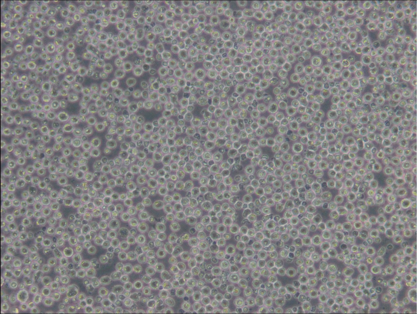 Namalwa-Zellen