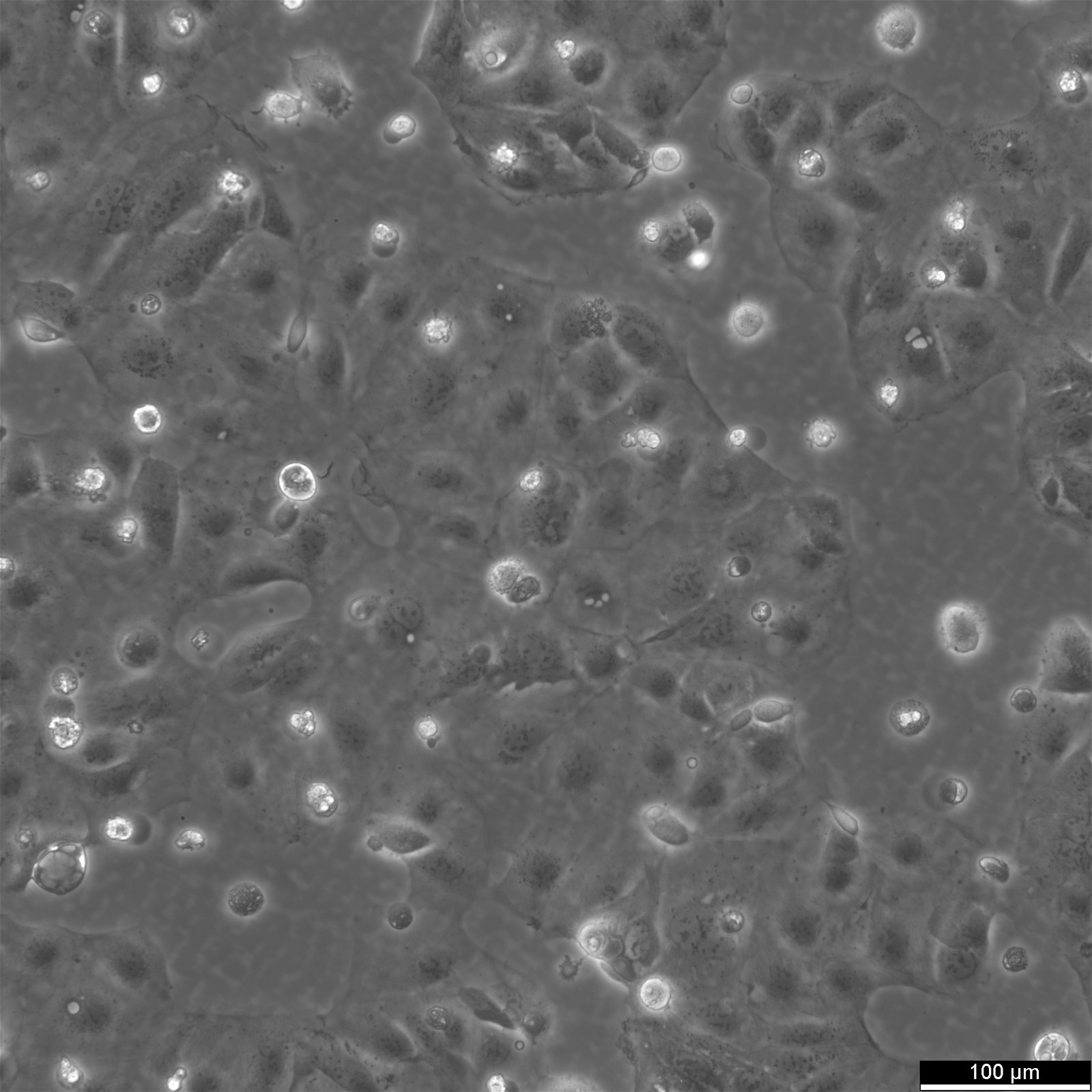 Caco-2 Cells