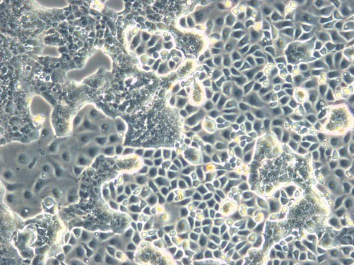 RPMI 2650 Cells