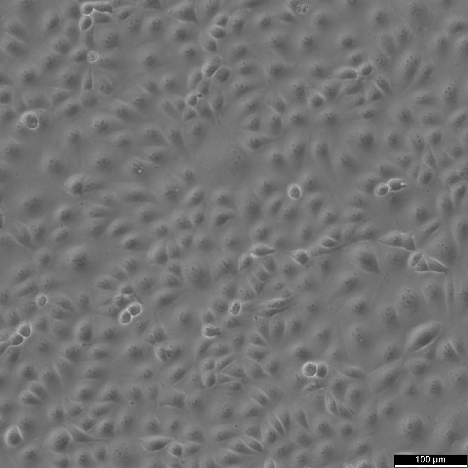 MARC-145 Cells MARC-145 Cells