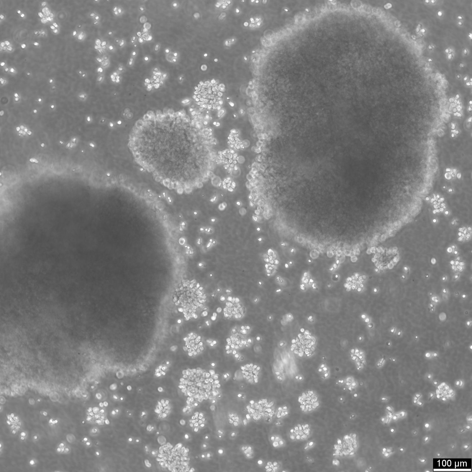 B-LCL-HROC69 Cells B-LCL-HROC69 Cells