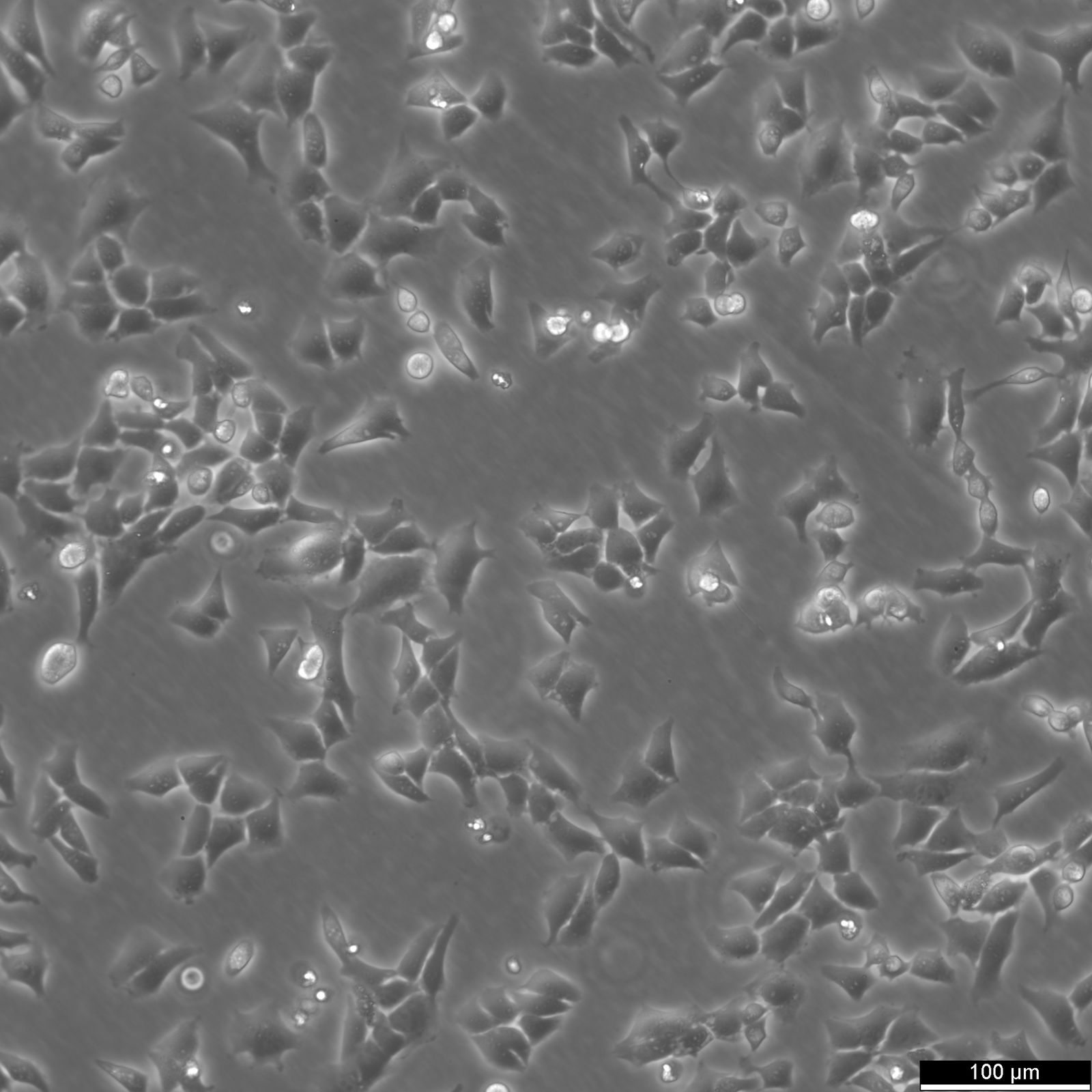 CHO Cells