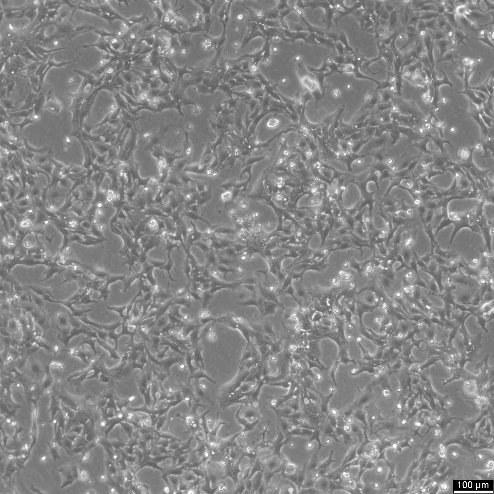BT-20 Cells