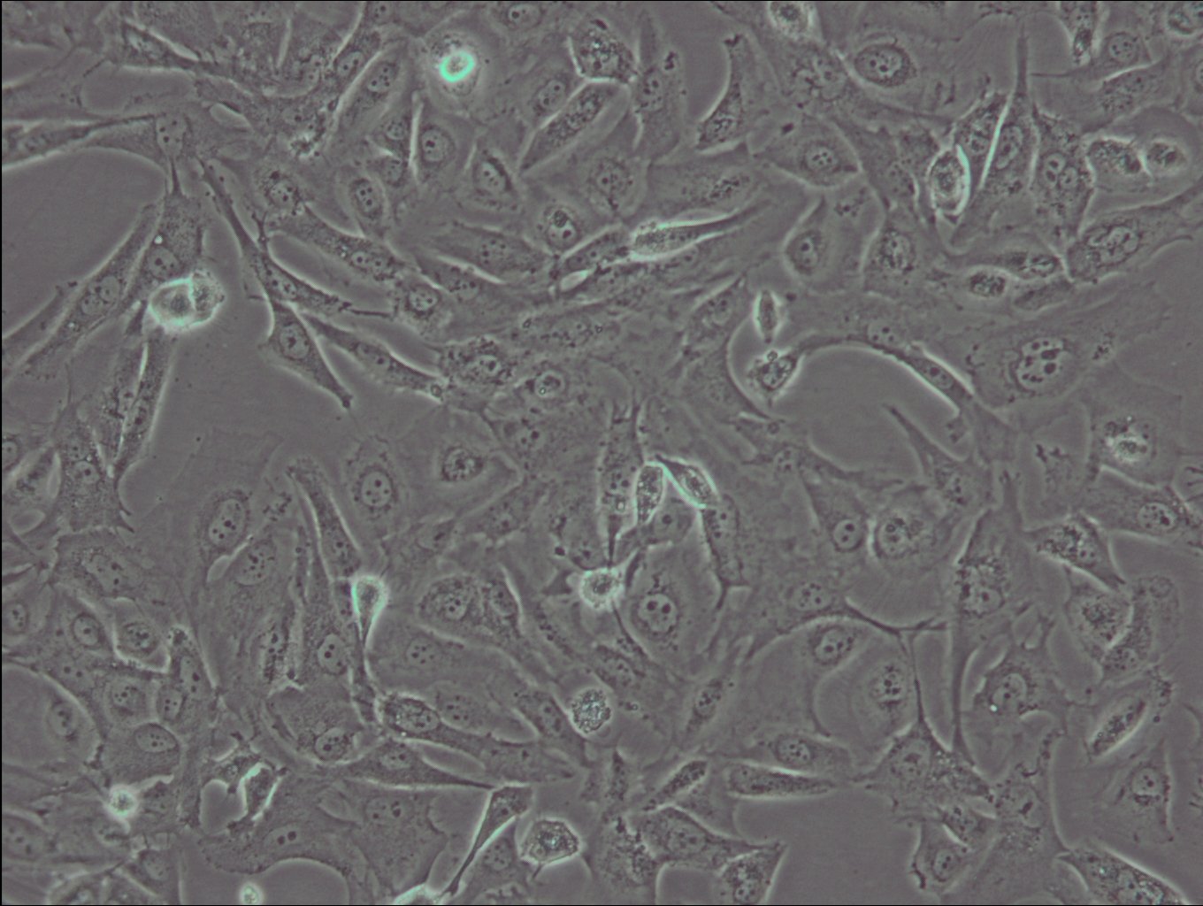J82 Cells