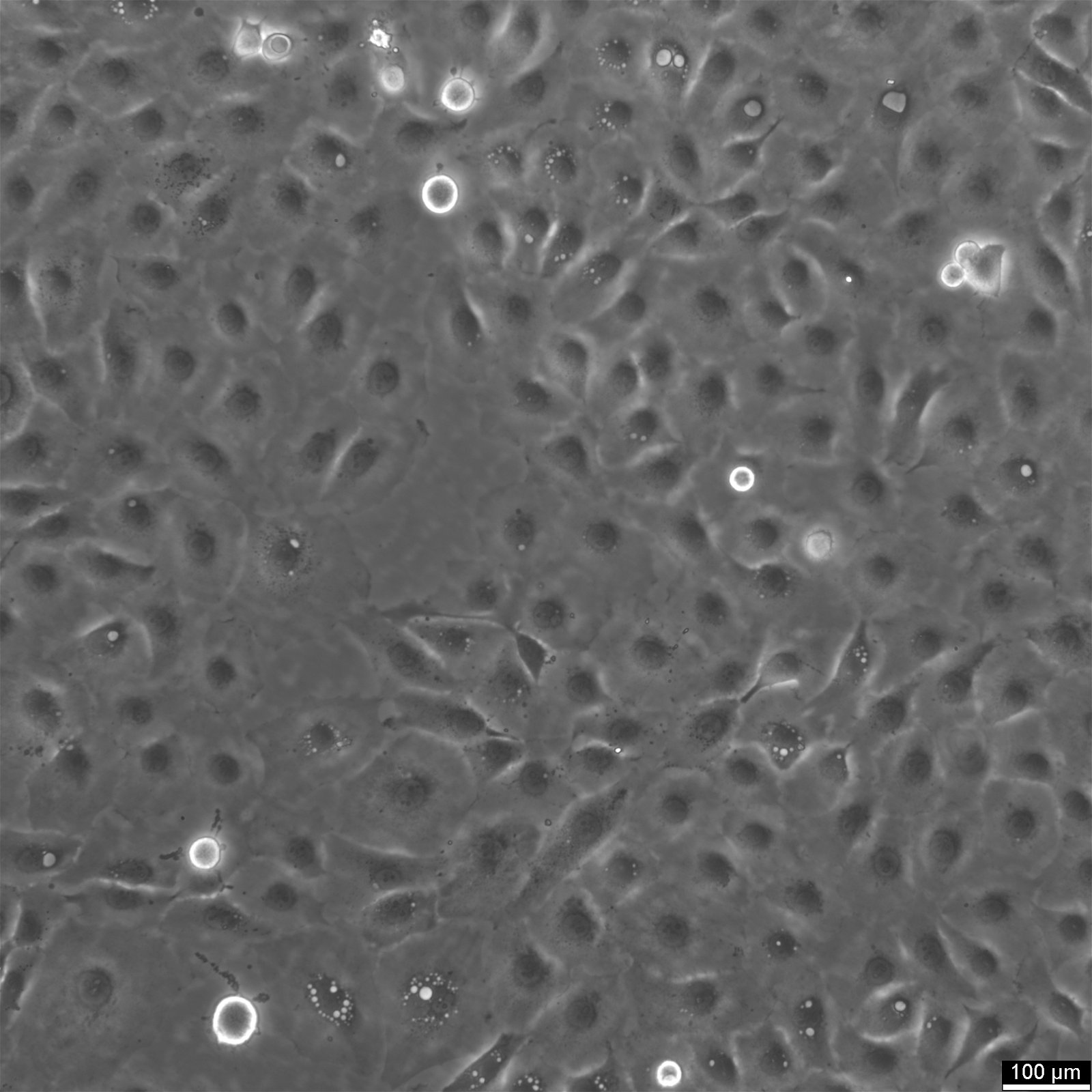 Cellules NCI-H1650