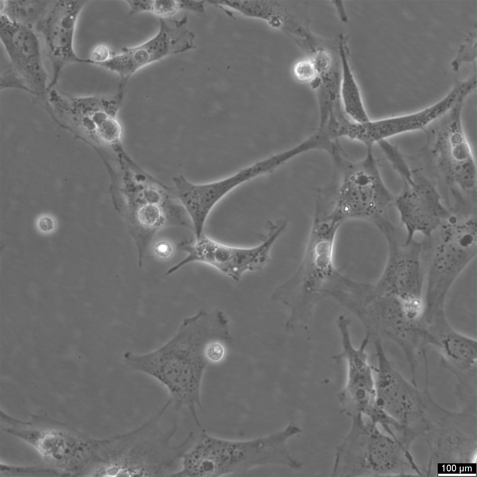 MC3T3-E1 Subclone 14 Zellen