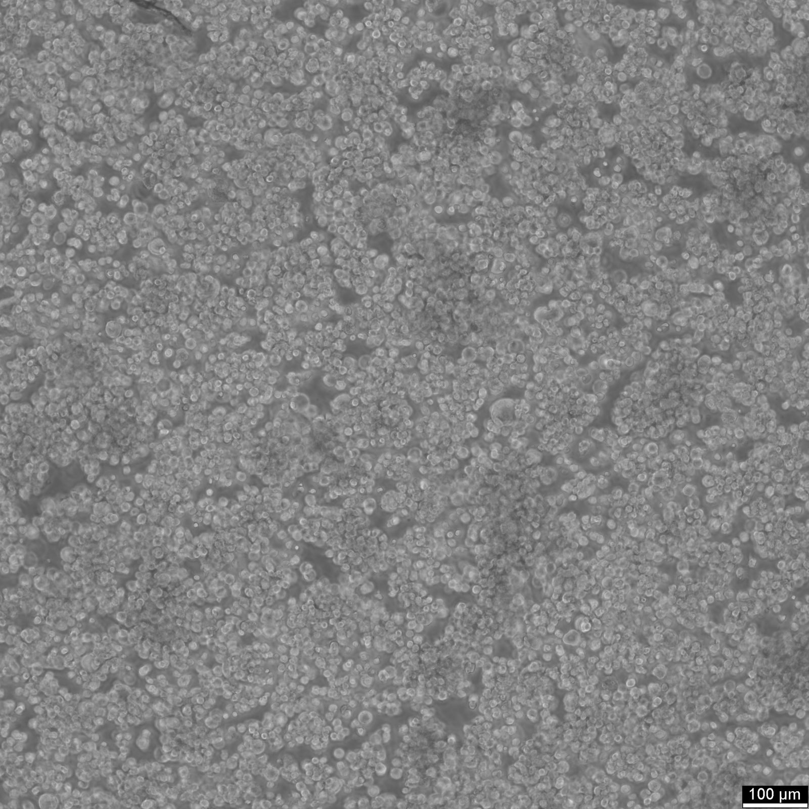 EB1 Cells EB1 Cells