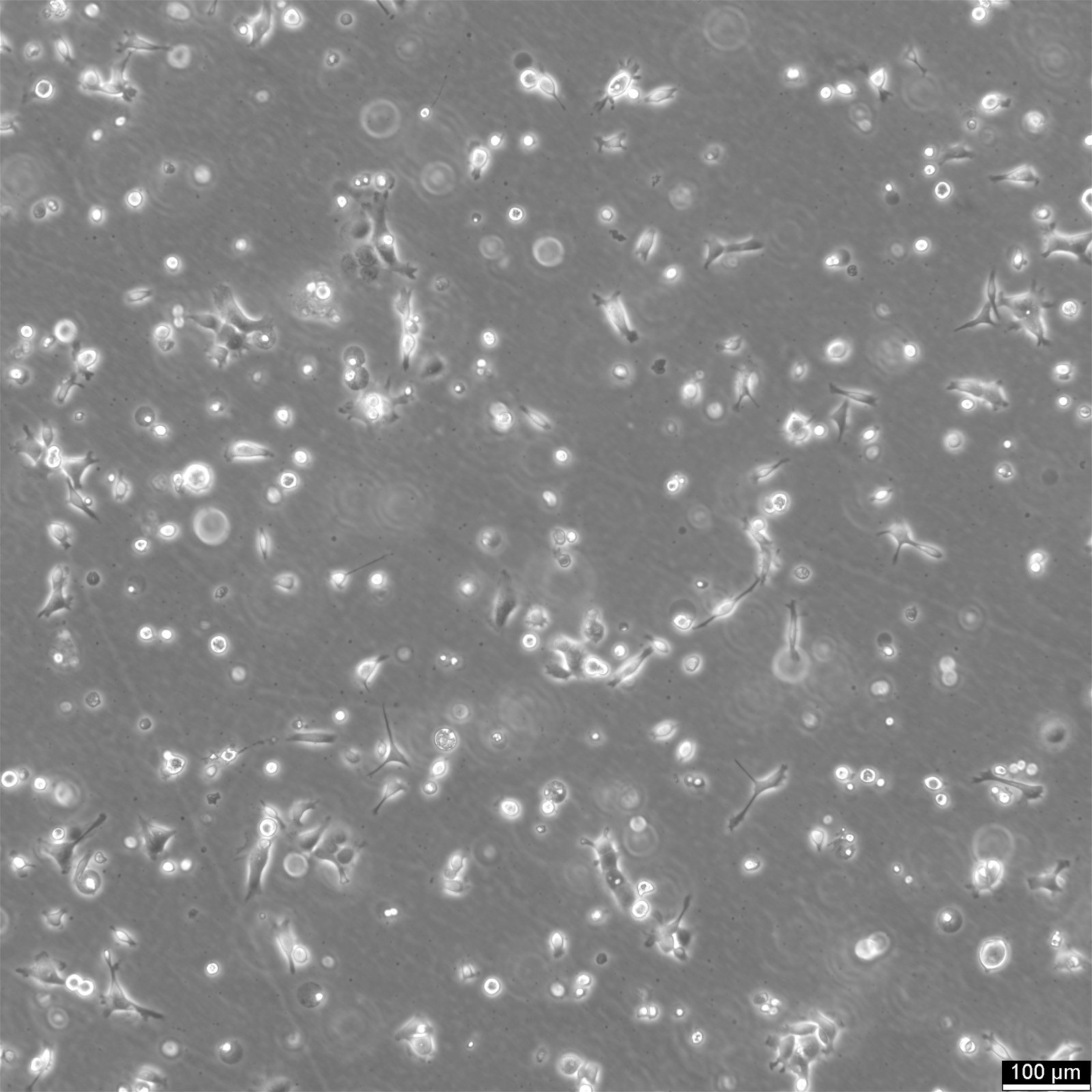 NCI-H1568 Cells