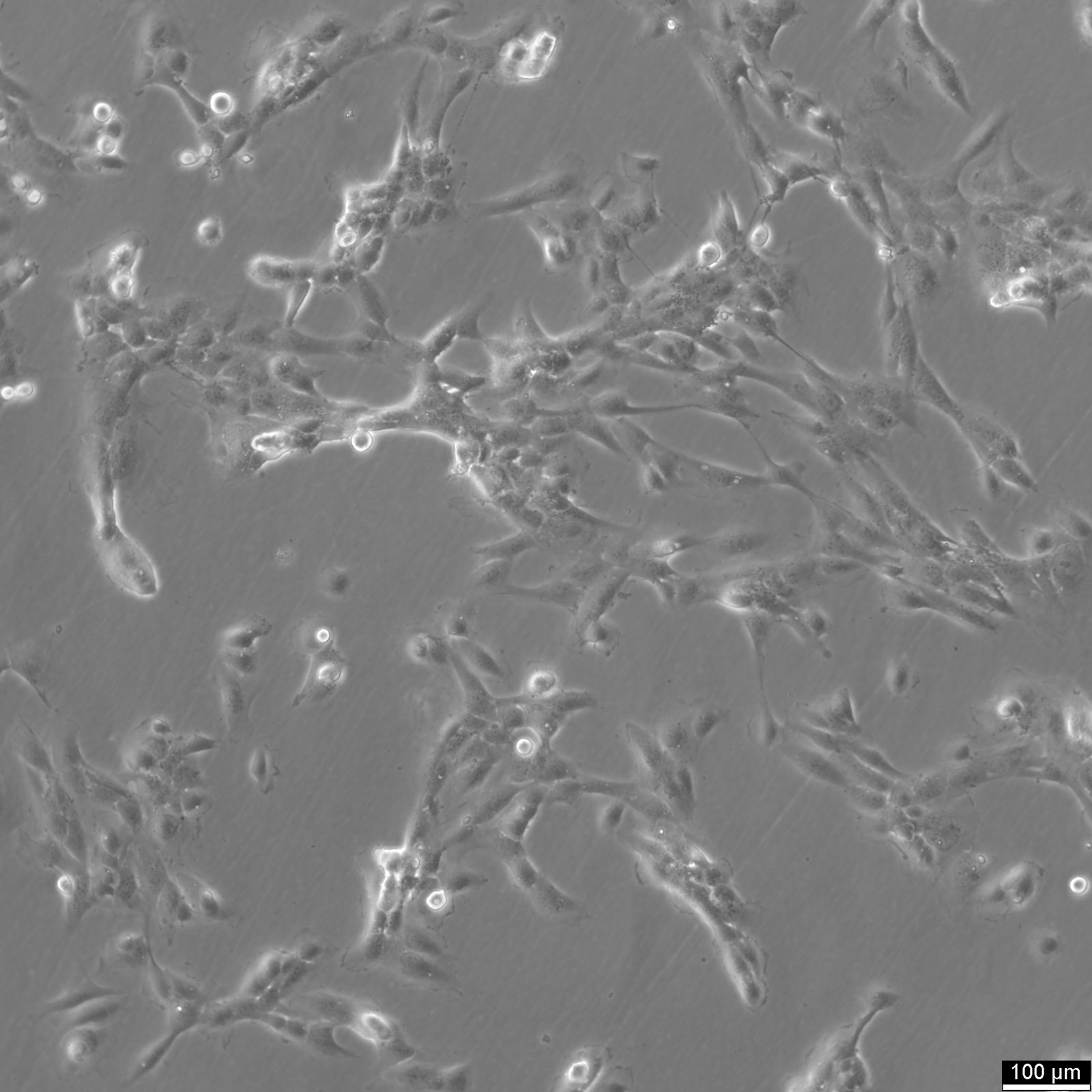 AC16 Cardiomyocyte Cell Line