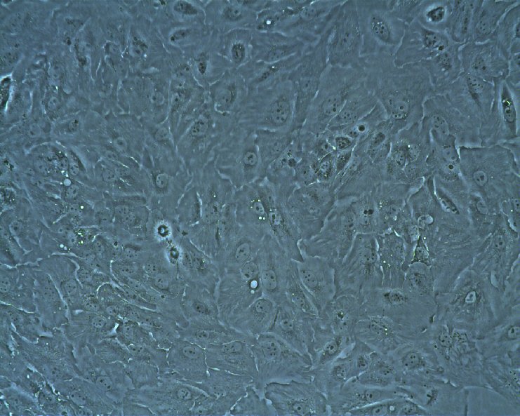 Cellules RCC-FG2