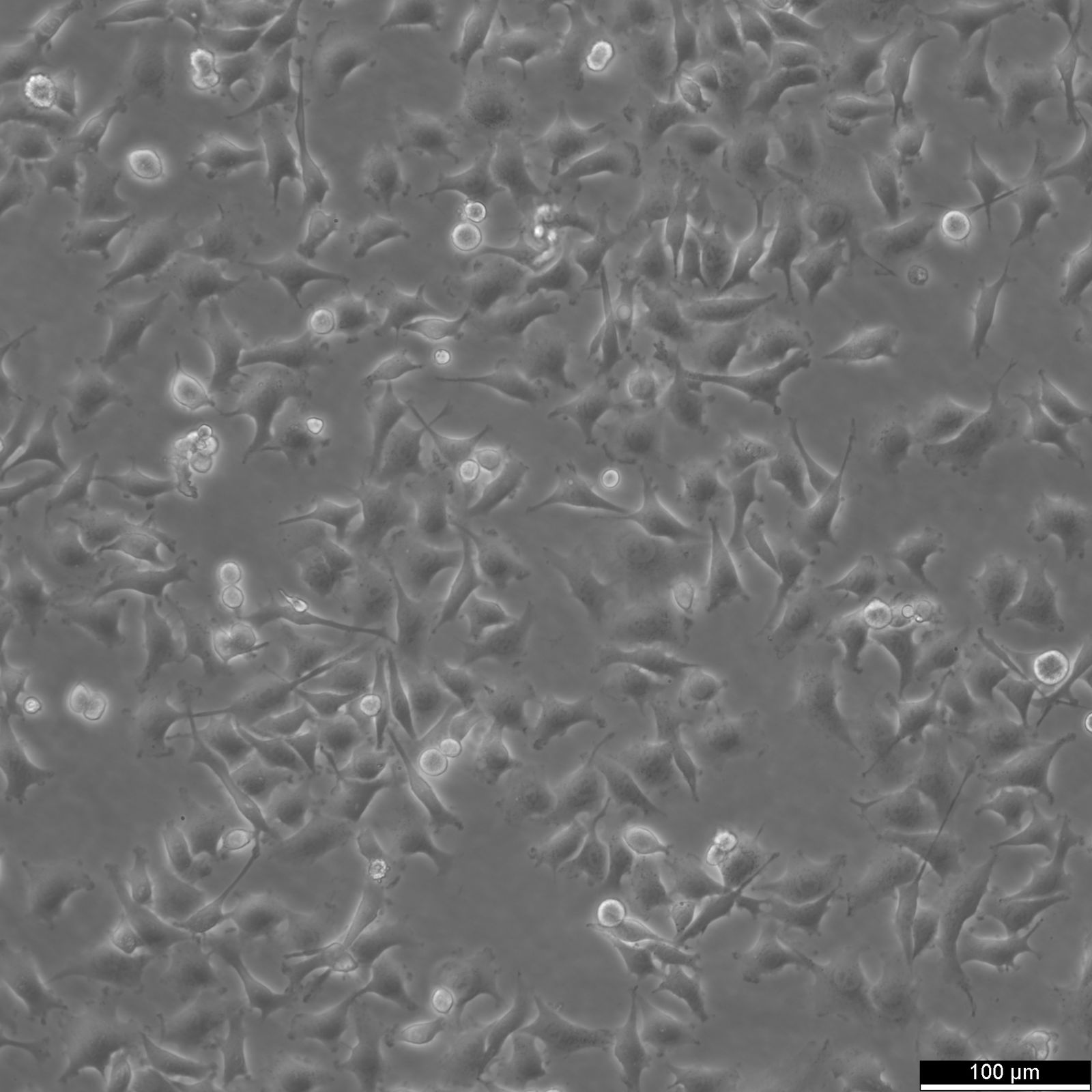 OVCAR-5