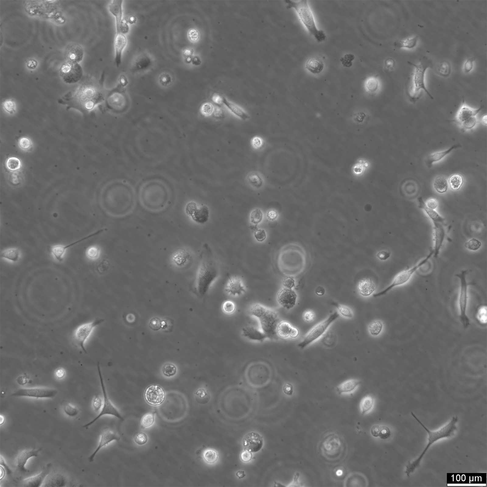 Cellules NCI-H1568