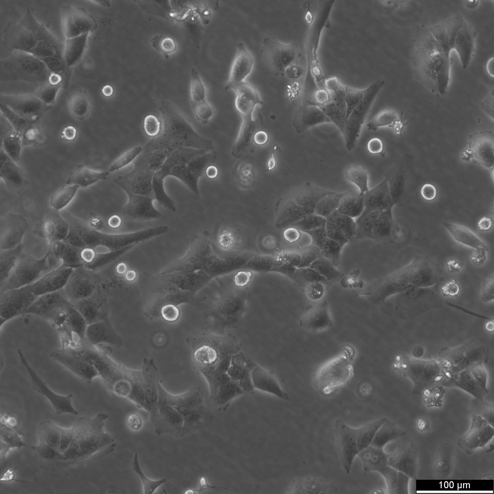 NCI-H2228 Cells NCI-H2228 Cells
