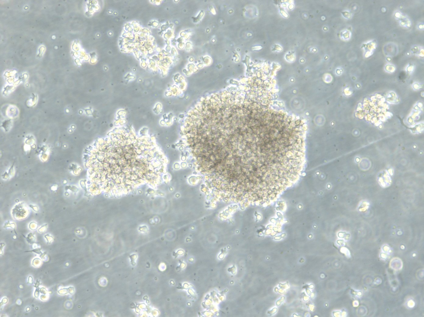 B-LCL-HROC24 Cells