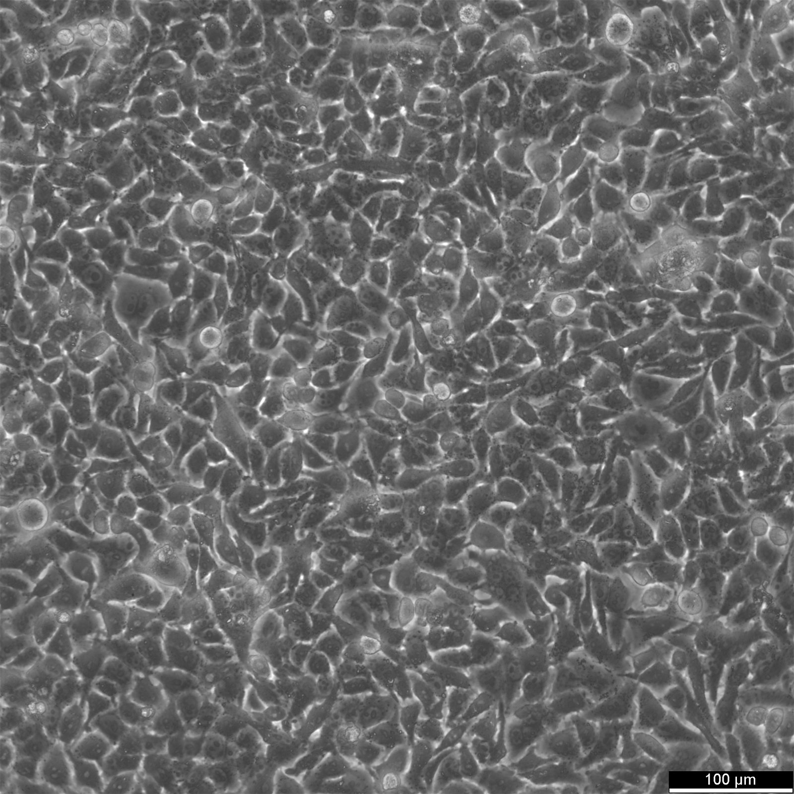 HK-CRISPR-Nup188-mEGFP #11-092 Cells