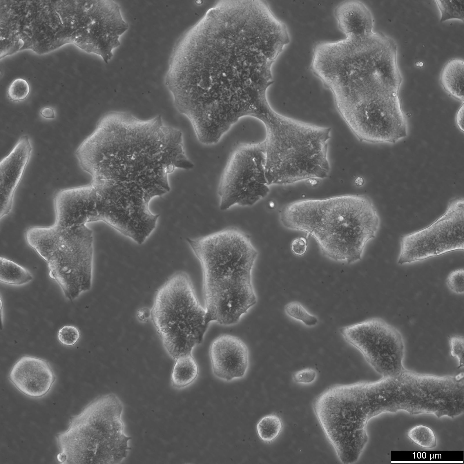 LS174T Cells LS174T Cells
