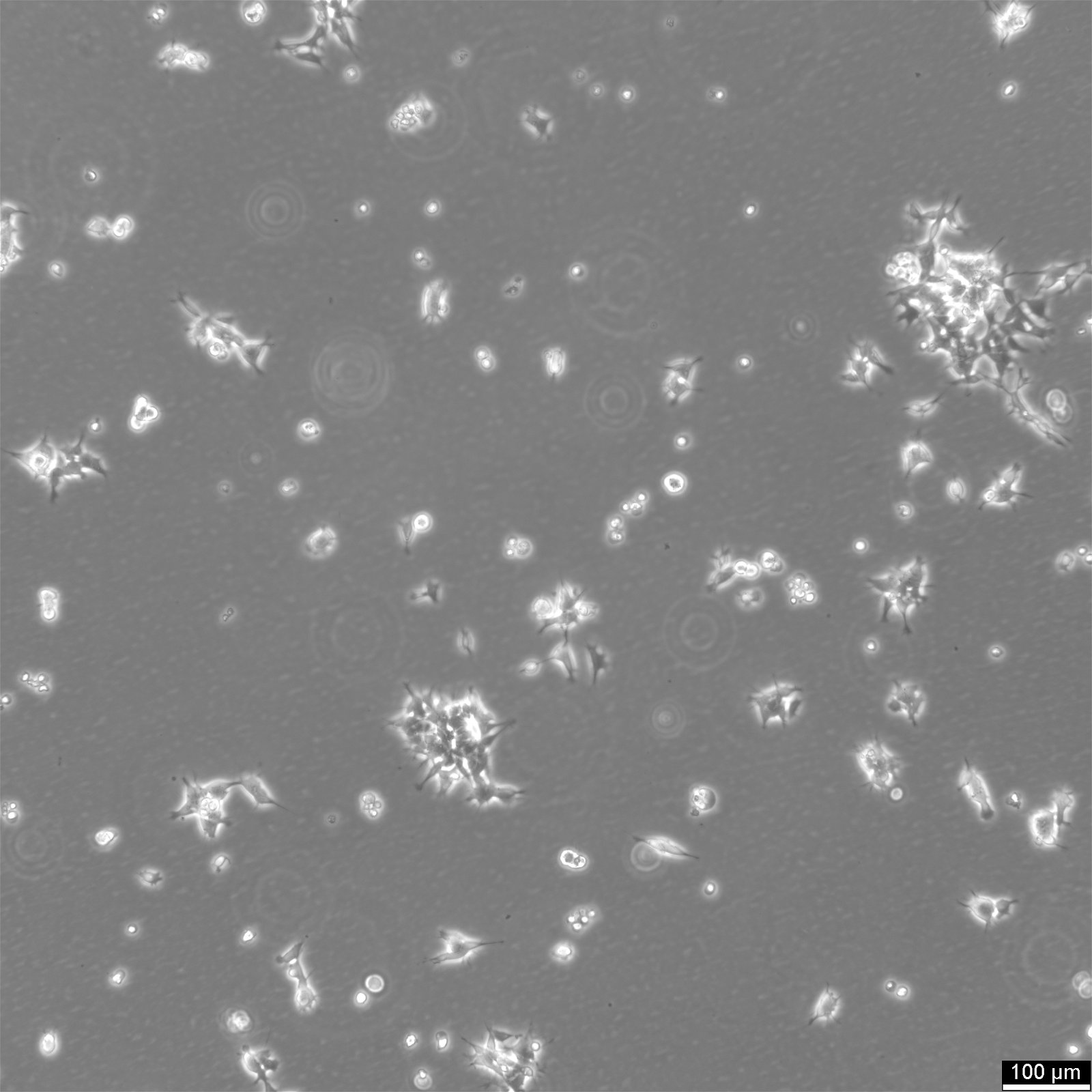 IMR-32 Cells