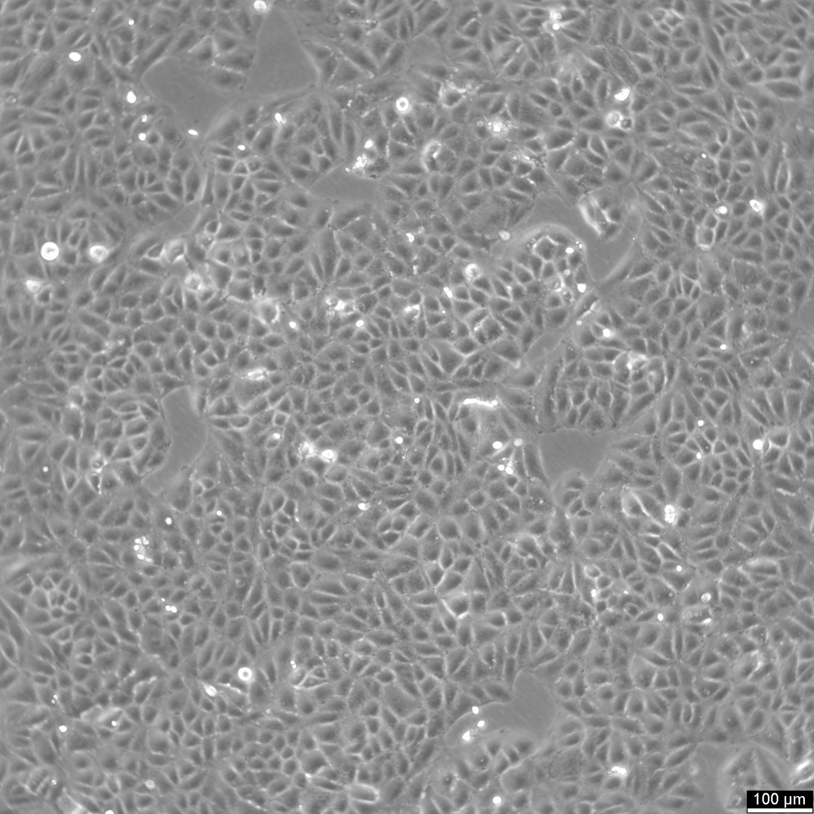 SNU-878 Cells