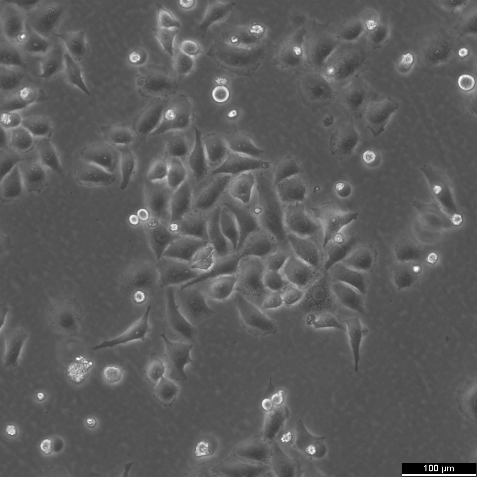 HK-CRISPR-Nup188-mEGFP #11-092 Cells