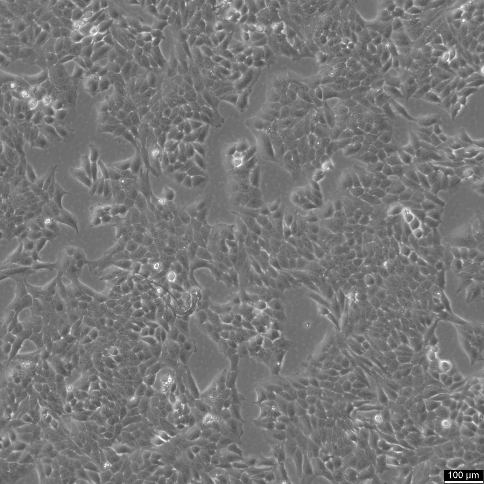 Hela 229 Cells Hela 229 Cells