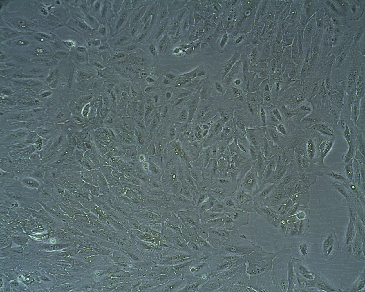 Cellules RCC-FG2