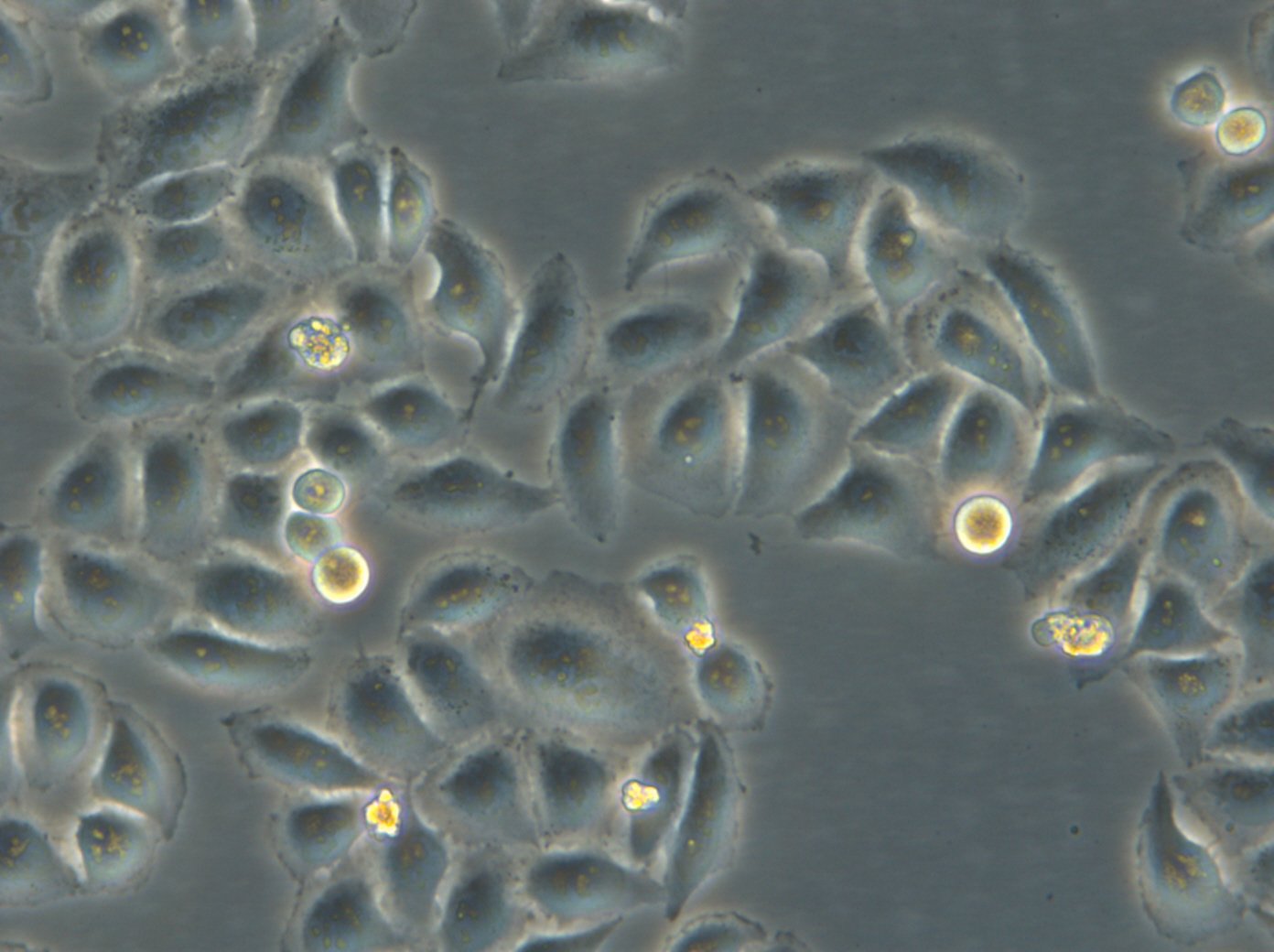Cellules HK-ZFN-AURKB-mEGFP