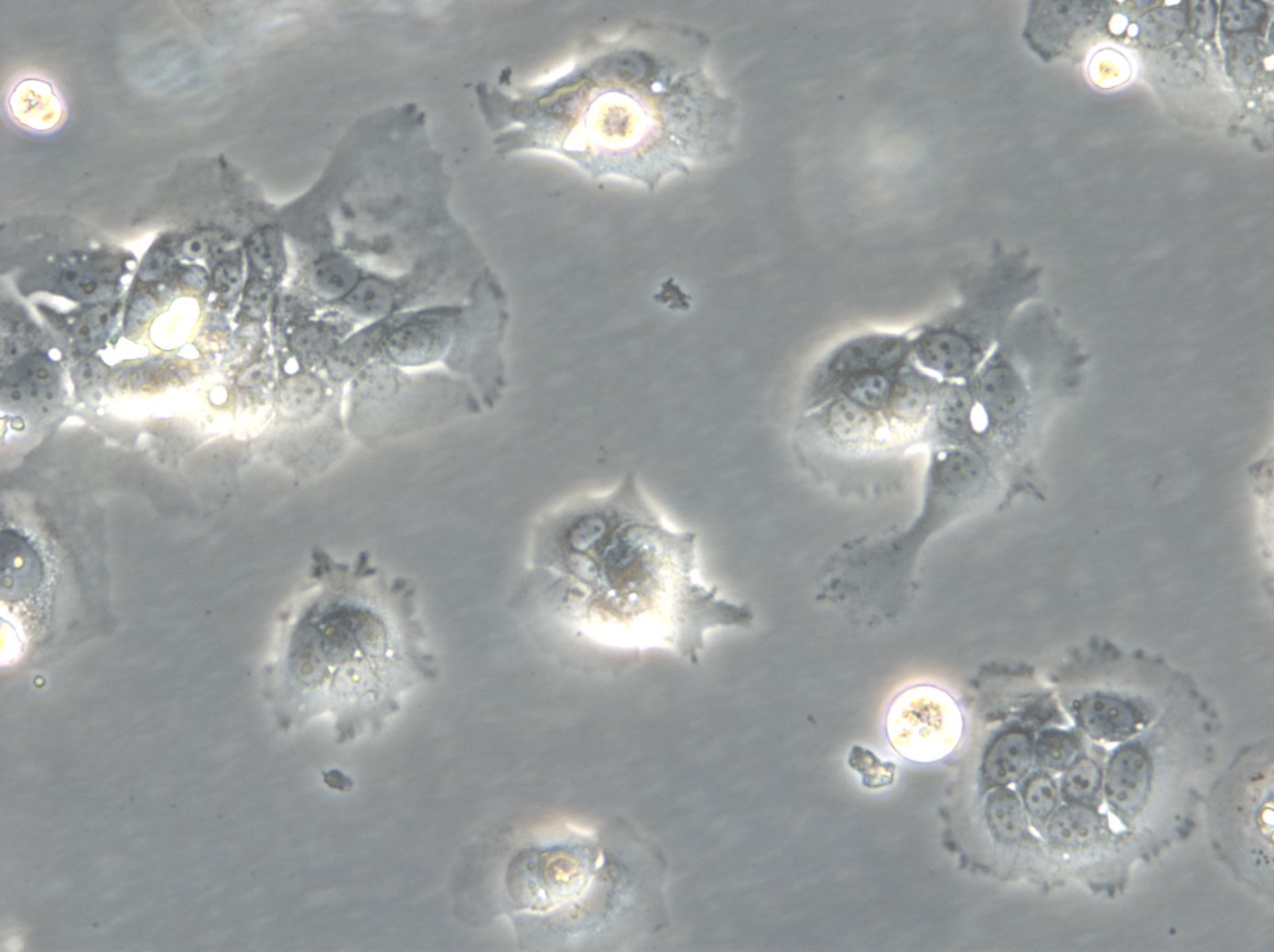 HROC284Met Cells