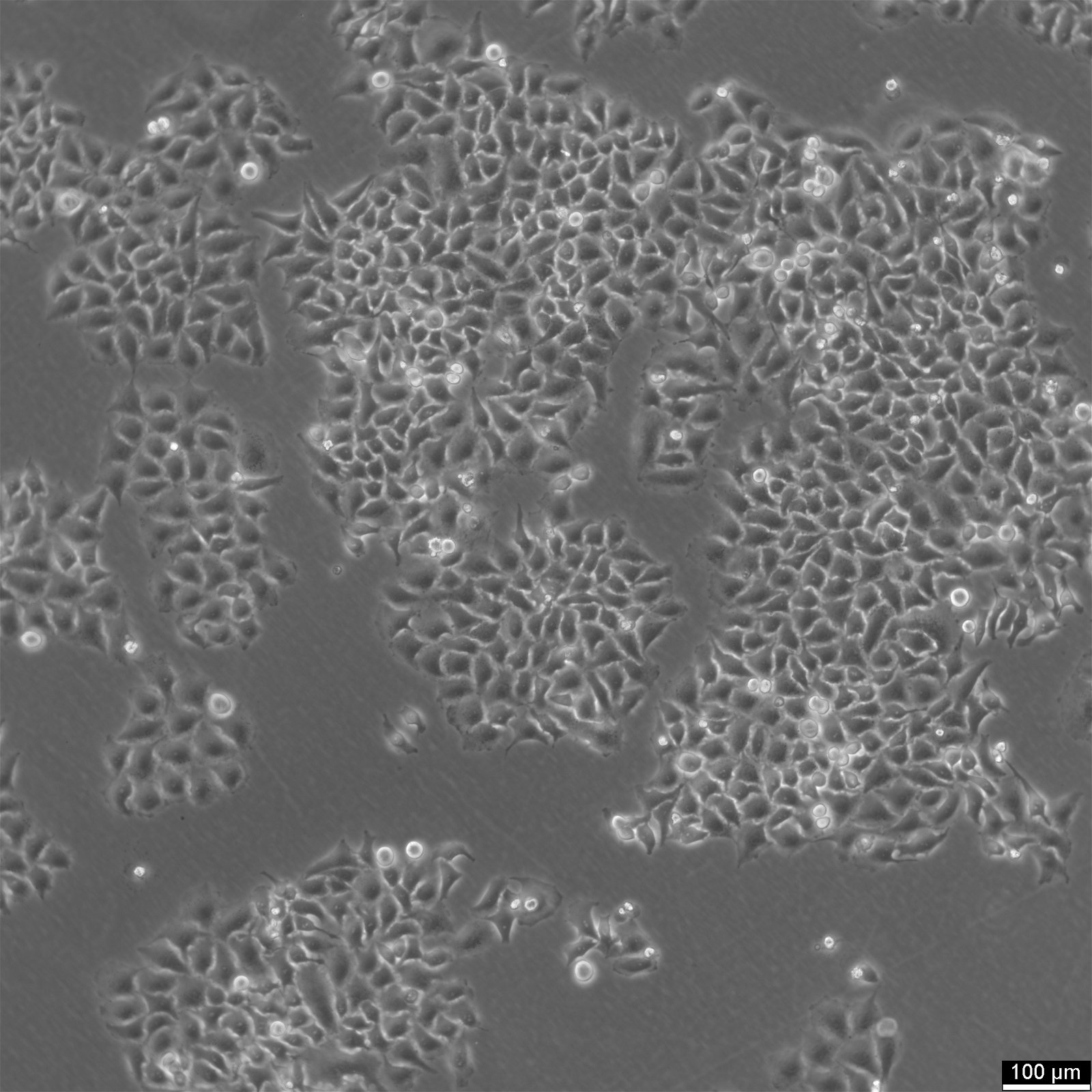 HK-CRISPR-Nup93-mEGFP #79 Cells