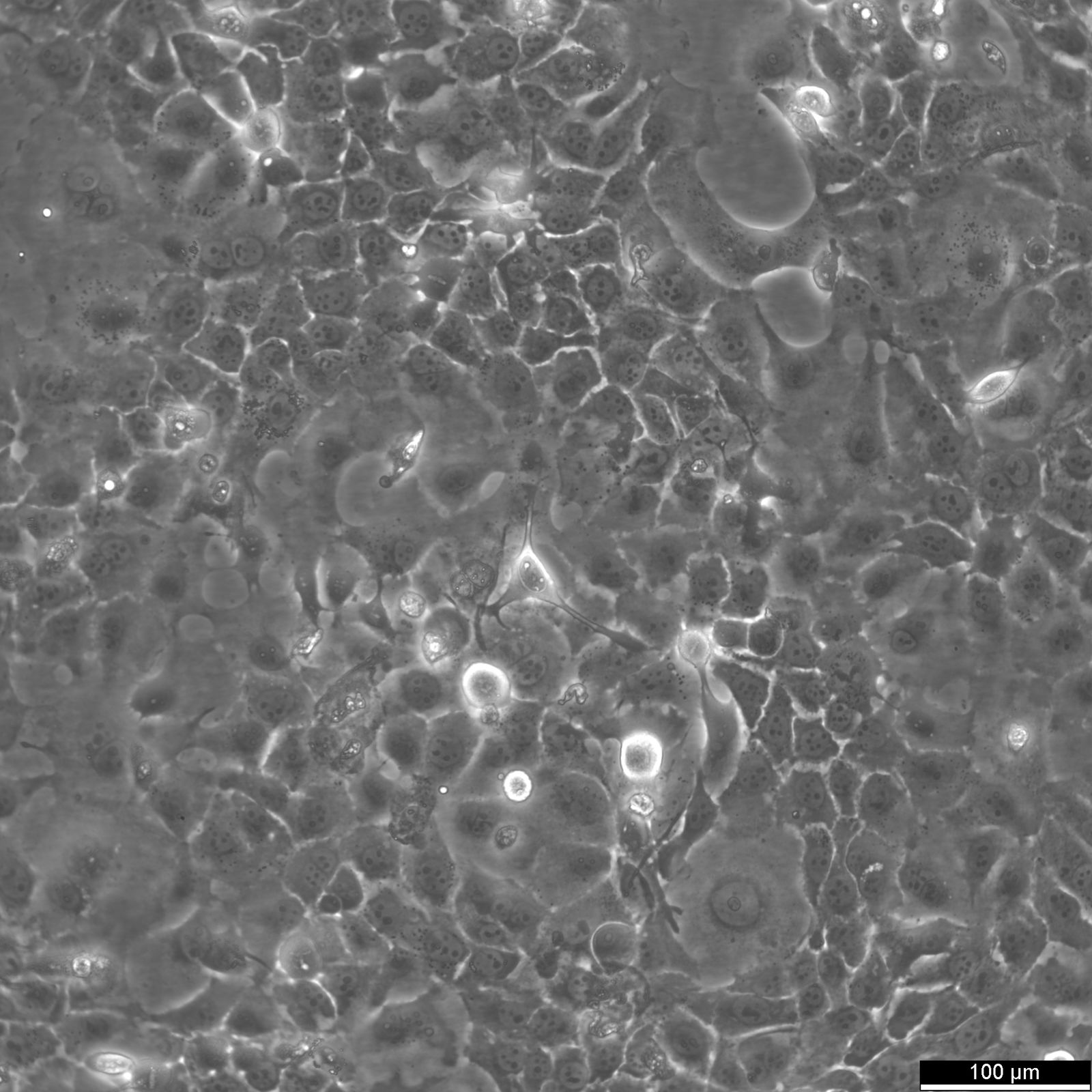 CLS-354 Cells CLS-354 Cells