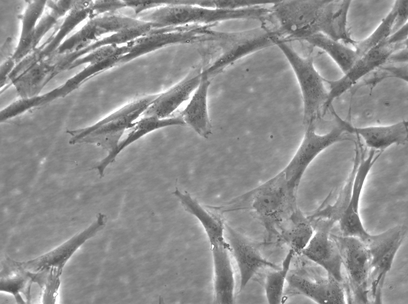 Cellules de fibroblastes de peau humaine (HFFC)