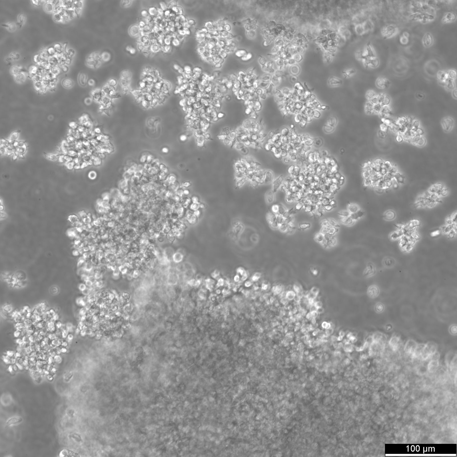 B-LCL-HROC69 Cells B-LCL-HROC69 Cells