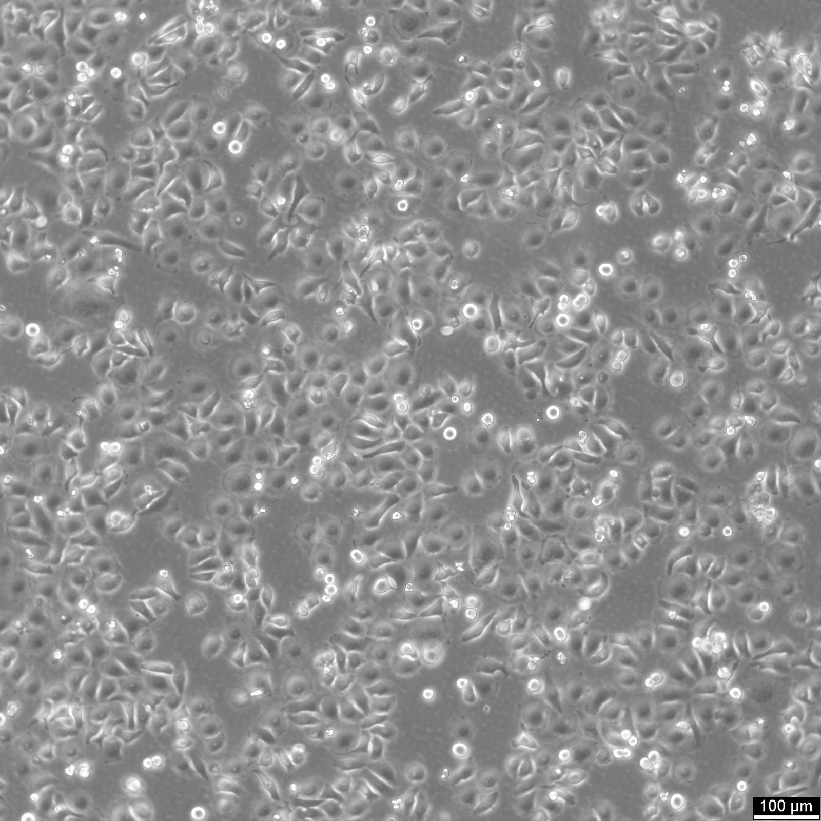 RT-112 Cells RT-112 Cells