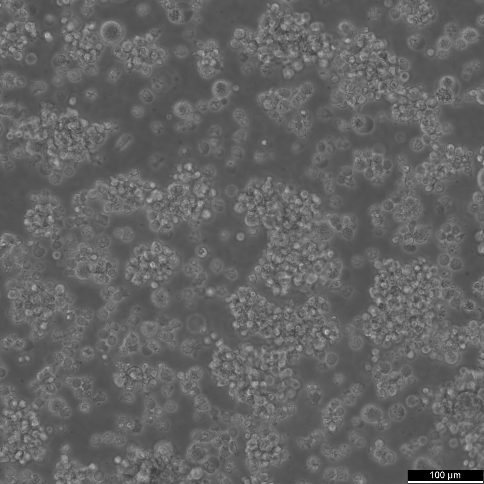 EB1 Cells EB1 Cells