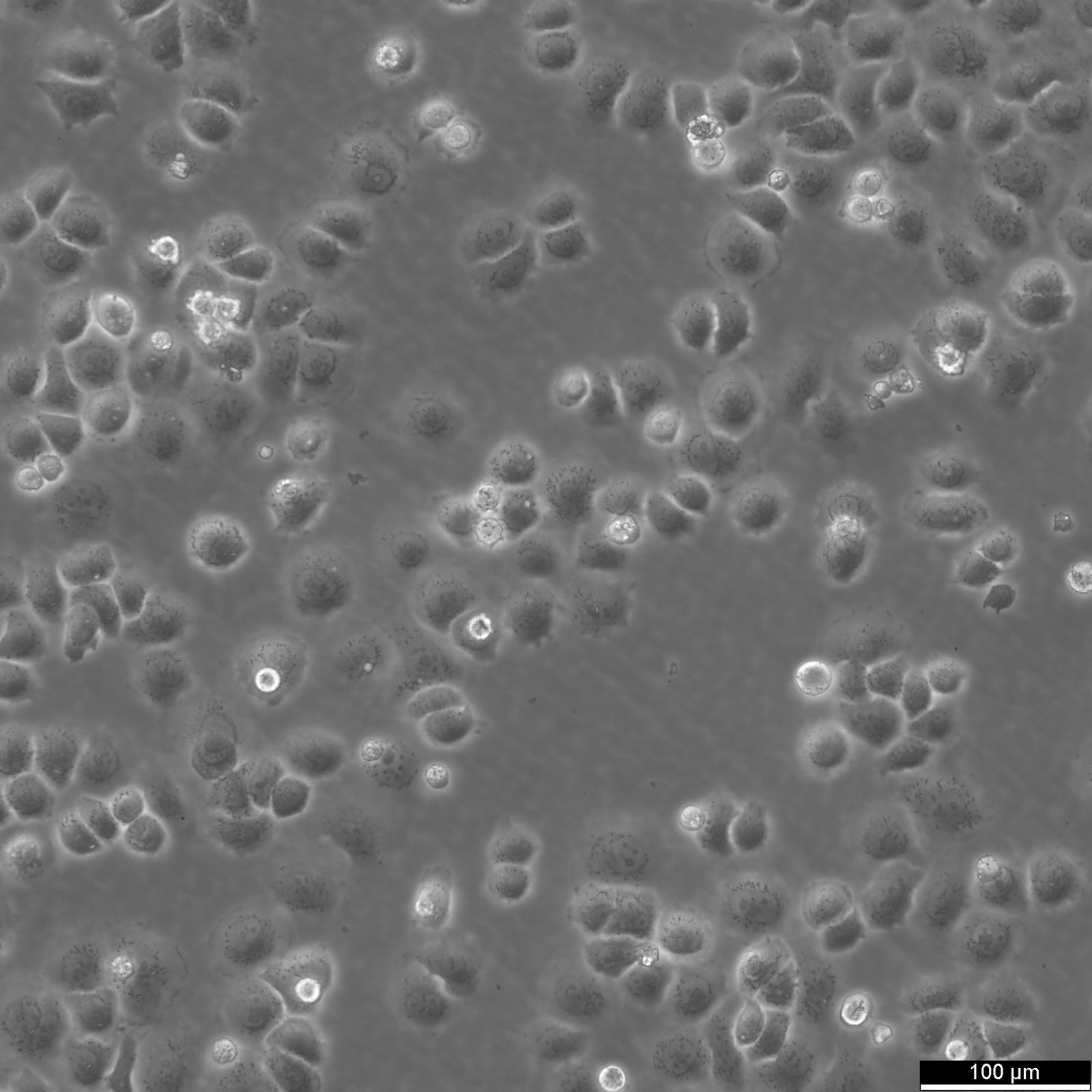 SW-13 Cells SW-13 Cells