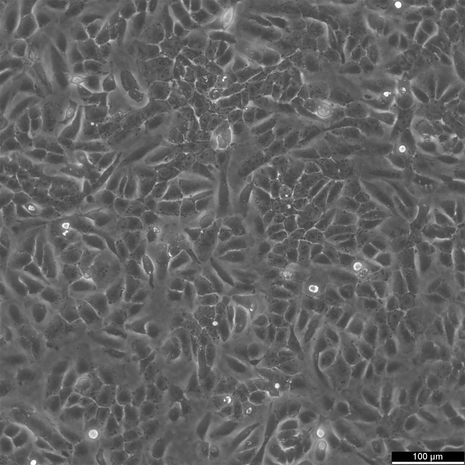 SUM149PT-Zellen