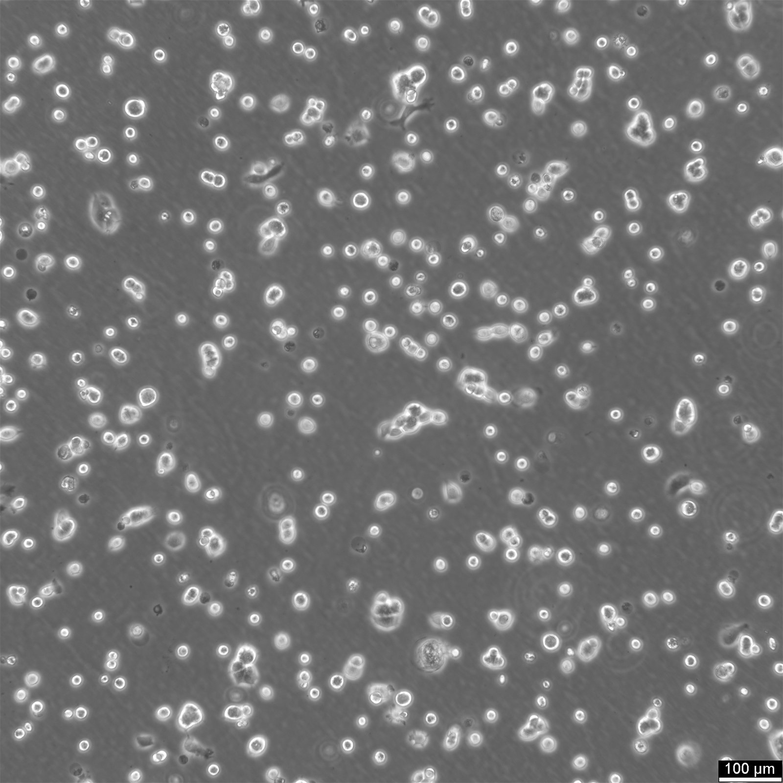 Cellules NCI-H358